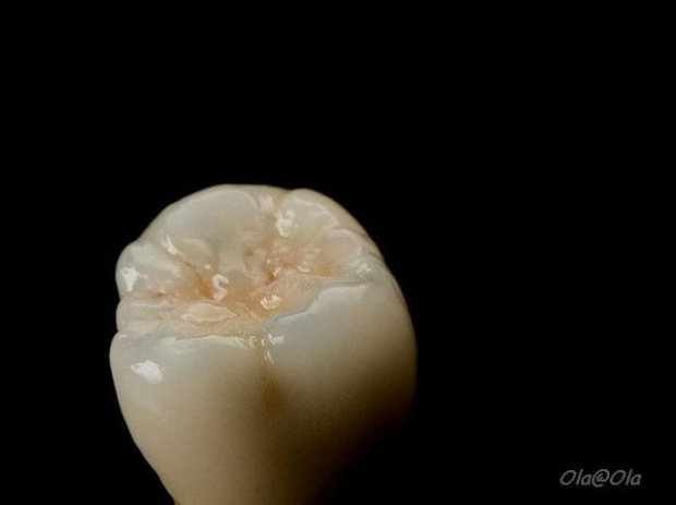 Ceramika dentystyczna #CeramikaDentystyczna #korony #mosty #ZębyZPorcelanany